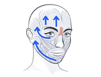 TecnoLift Facial: Abordaje Kinésico